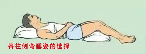 睡姿不正確會(huì)對(duì)脊柱側(cè)彎產(chǎn)生影響嗎？